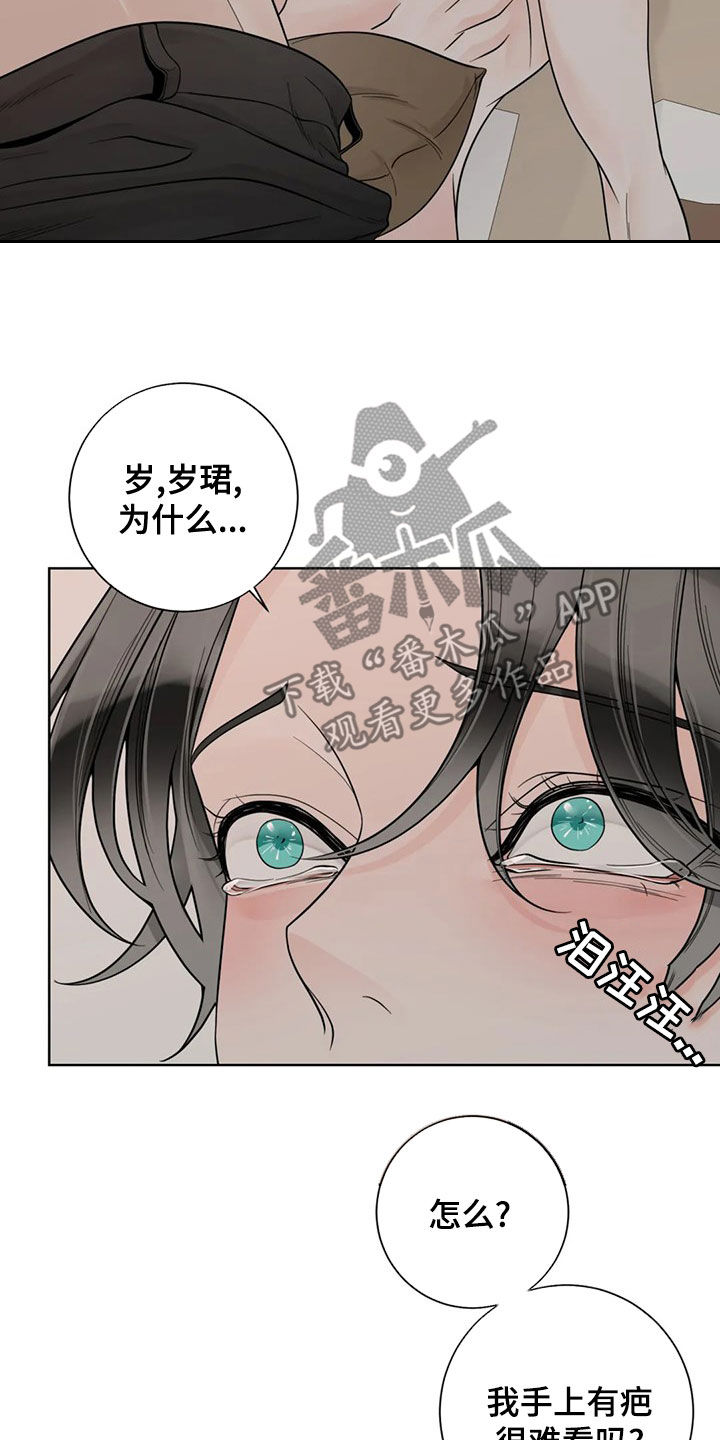 《合约期伙伴》第128章【番外】伤疤 第14页