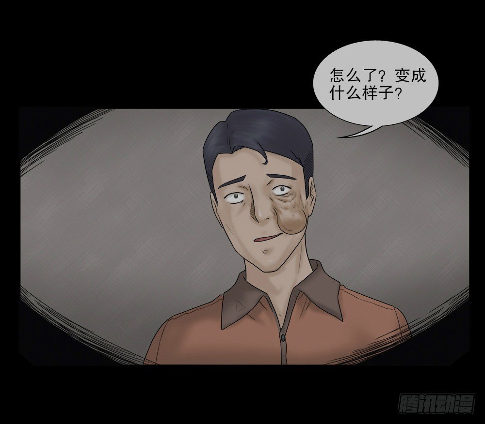 《怪奇笔记（怪奇脑洞集）》奇异的瘤 第11页