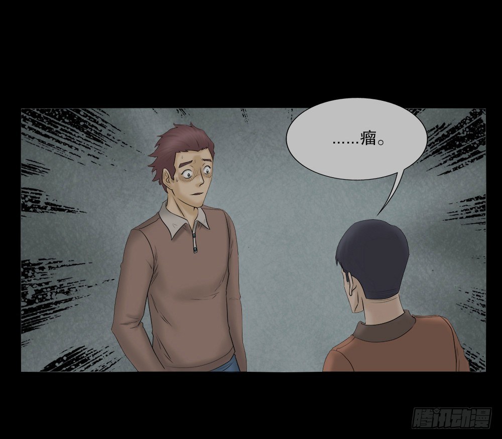 《怪奇笔记（怪奇脑洞集）》奇异的瘤 第16页