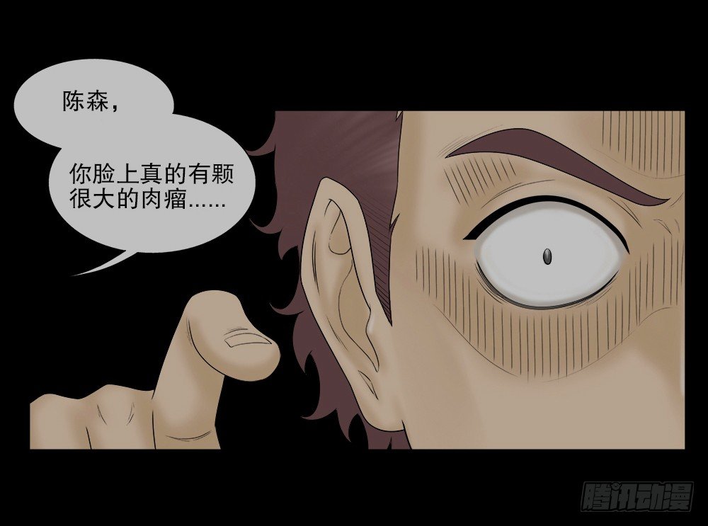 《怪奇笔记（怪奇脑洞集）》奇异的瘤 第17页