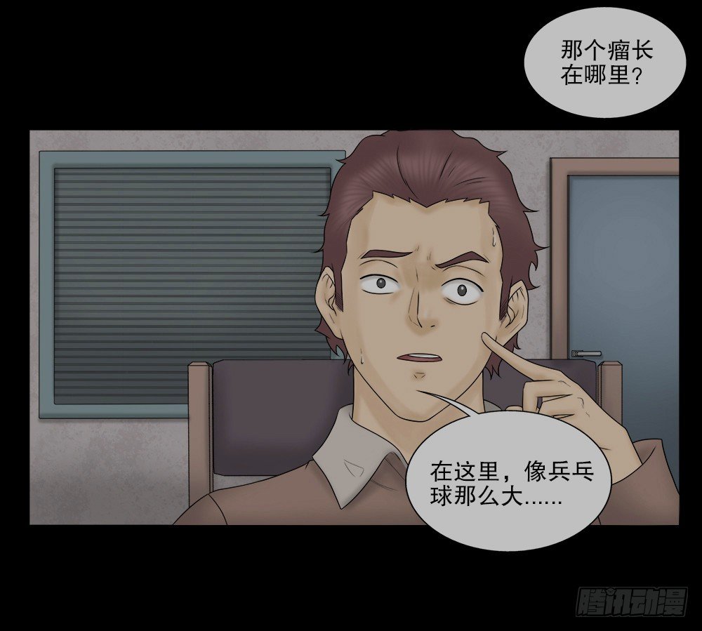 《怪奇笔记（怪奇脑洞集）》奇异的瘤 第20页