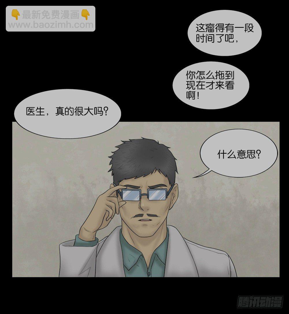 《怪奇笔记（怪奇脑洞集）》奇异的瘤 第30页