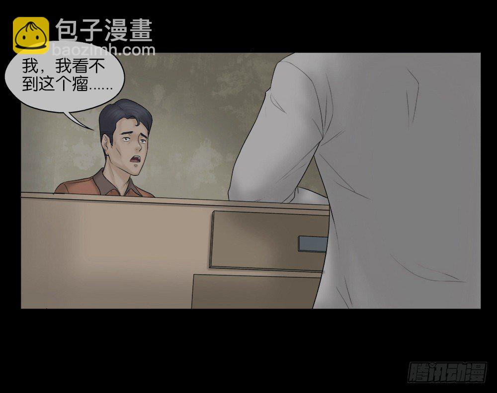 《怪奇笔记（怪奇脑洞集）》奇异的瘤 第31页