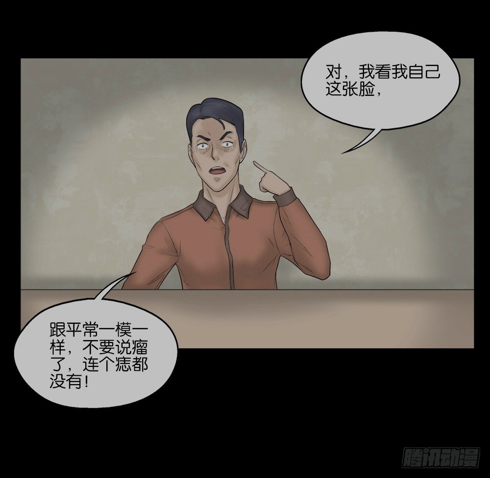 《怪奇笔记（怪奇脑洞集）》奇异的瘤 第33页