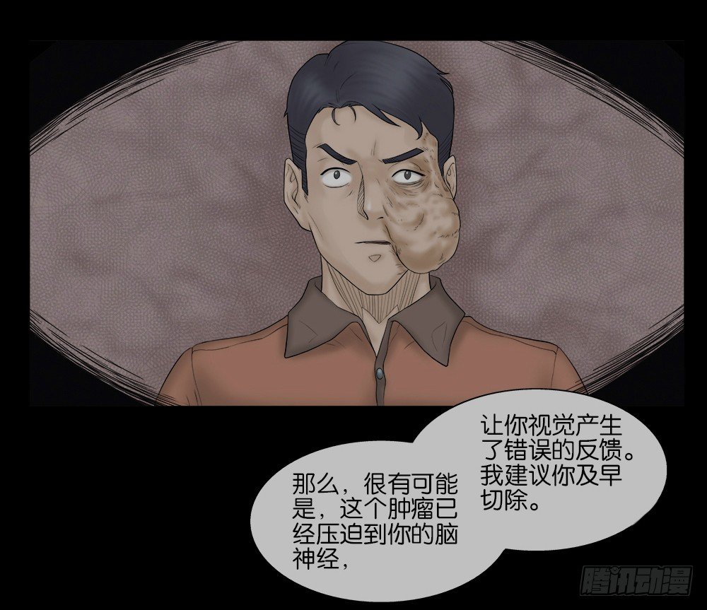 《怪奇笔记（怪奇脑洞集）》奇异的瘤 第35页