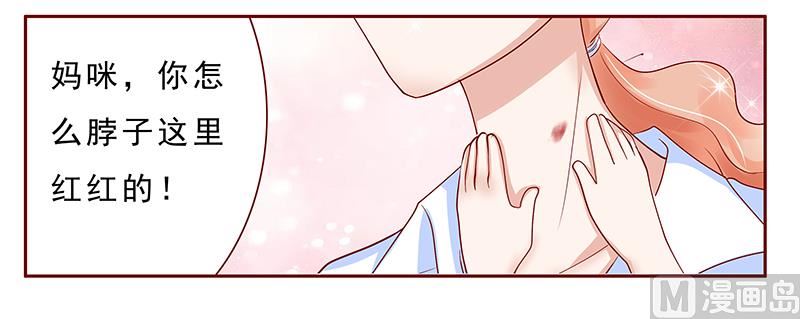 《霸道首席爱上我》第181话 脖子这里红红的 第20页