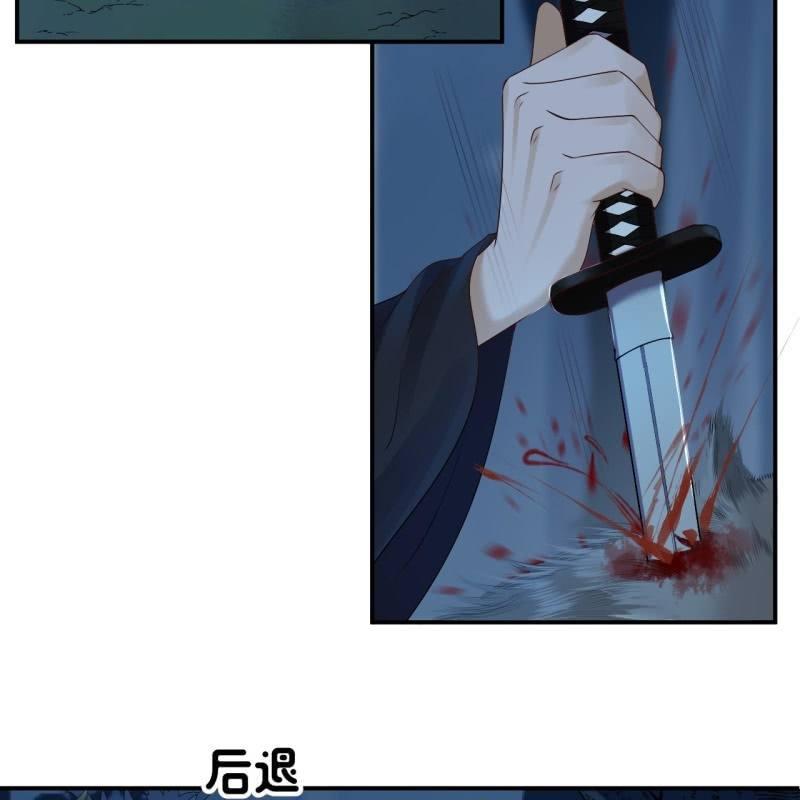 《傲娇王爷太难追》第125话 我能把他的手接上 第4页