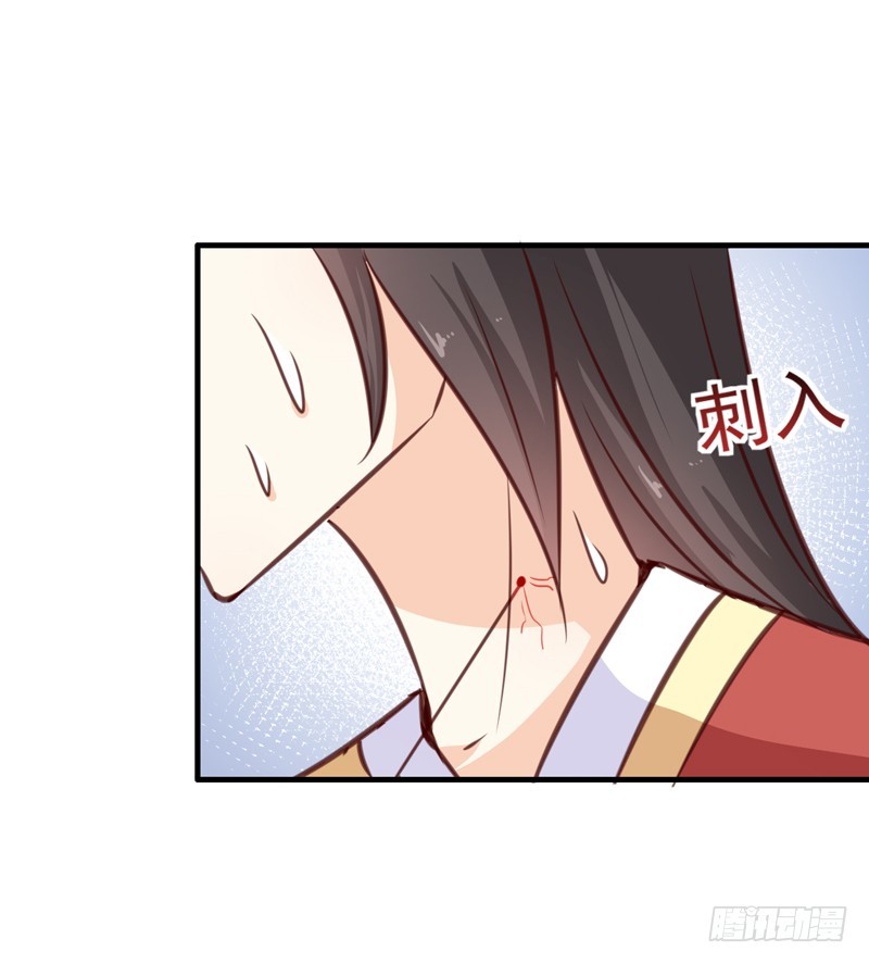 《天才小毒妃（《芸汐传》原作）》第137话 毒人 第29页
