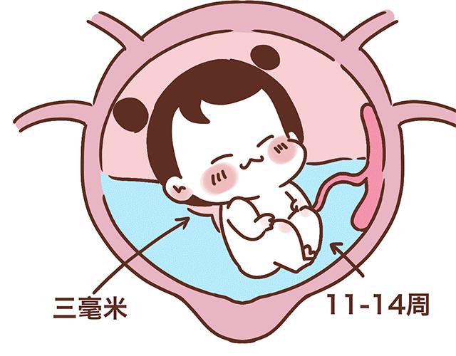 《41厘米的超幸福》第139话 酱子的产检小知识 第29页