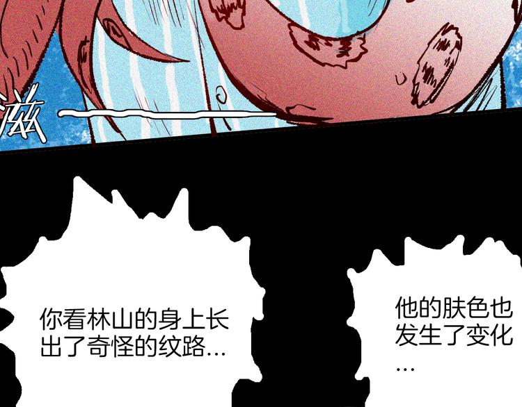 《山林怪谈》第64话 骨头溶解症（下） 第21页