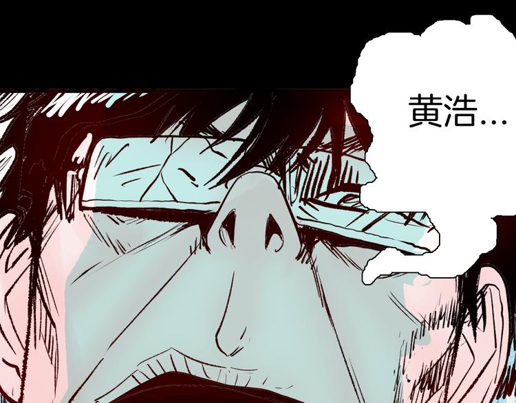 《山林怪谈》第64话 骨头溶解症（下） 第25页