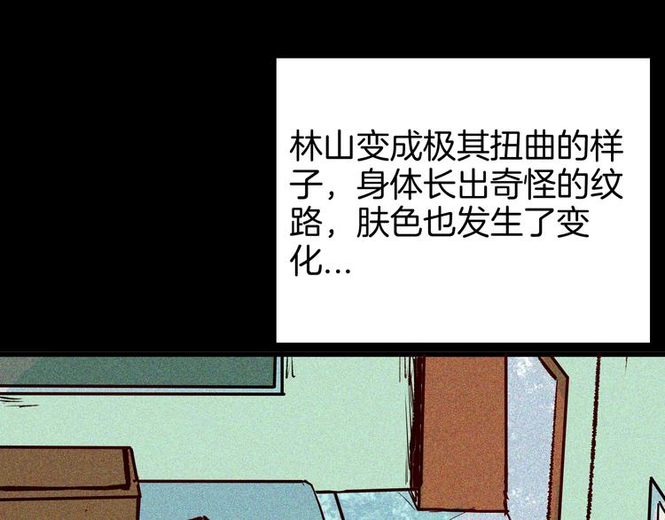 《山林怪谈》第64话 骨头溶解症（下） 第34页