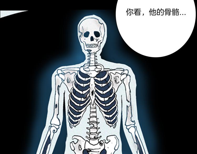 《山林怪谈》第63话 骨头溶解症（上） 第45页