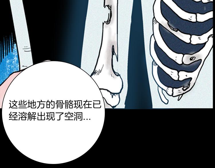 《山林怪谈》第63话 骨头溶解症（上） 第48页