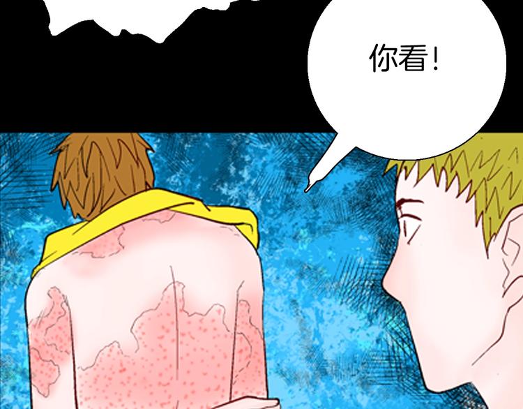 《山林怪谈》第92话 皮肤病患者 第23页