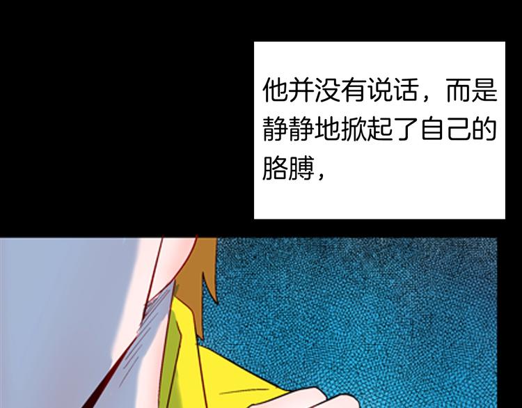 《山林怪谈》第92话 皮肤病患者 第48页