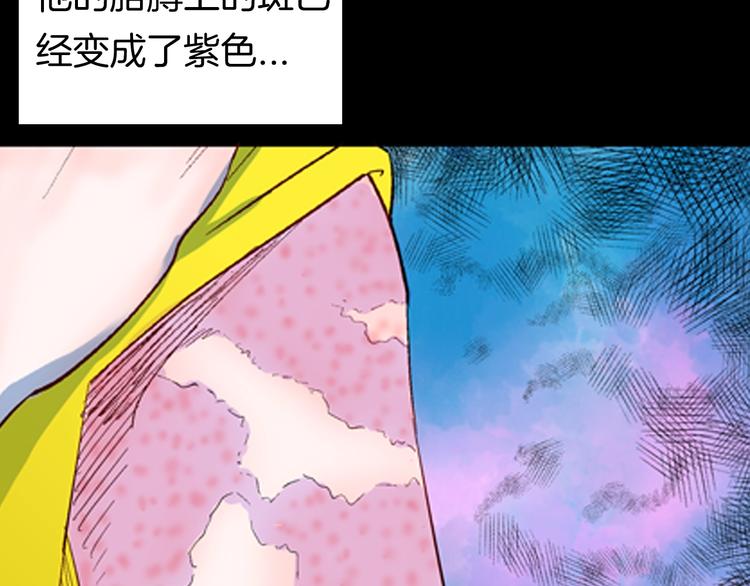 《山林怪谈》第92话 皮肤病患者 第50页