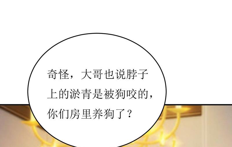 《嗜血老公错嫁新娘休想逃》第75话 被狗咬的 第27页