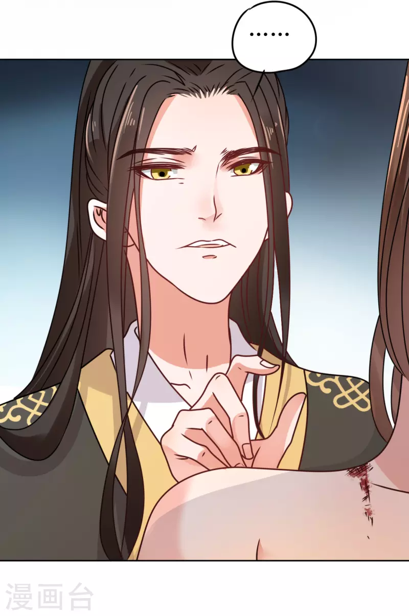 《我家侯爷不宠我》第51话 亲手为她上药 第25页
