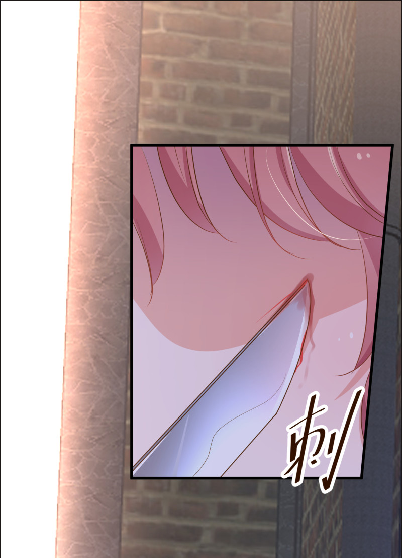 《暖婚100分总裁轻点宠》第87话 受到伤害 第11页