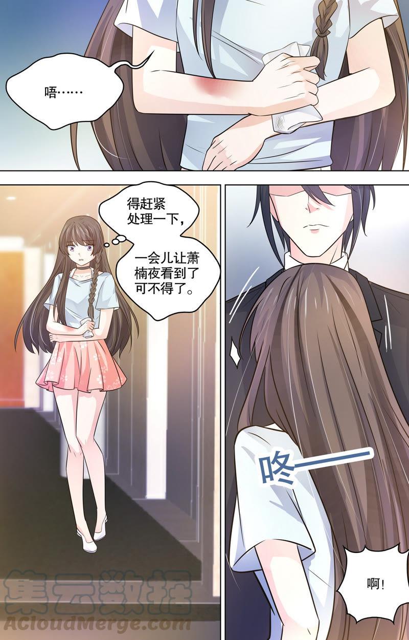 《亿万总裁缠上我天价婚约》第101话 保护伤口 第3页