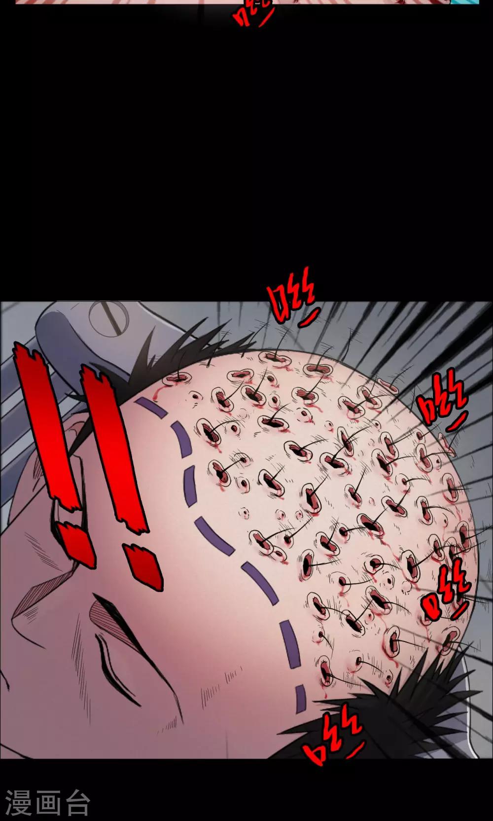 《密集黑洞》第19话 植发4 第5页