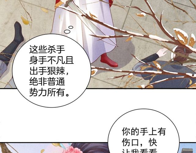 《盛宠医妃之摇光传》第80话 他的心跳 第29页