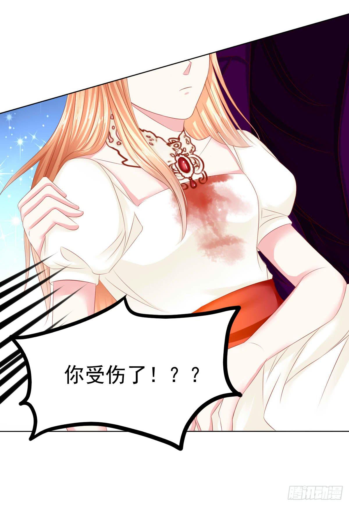 《废柴皇帝进化史》受伤 第17页