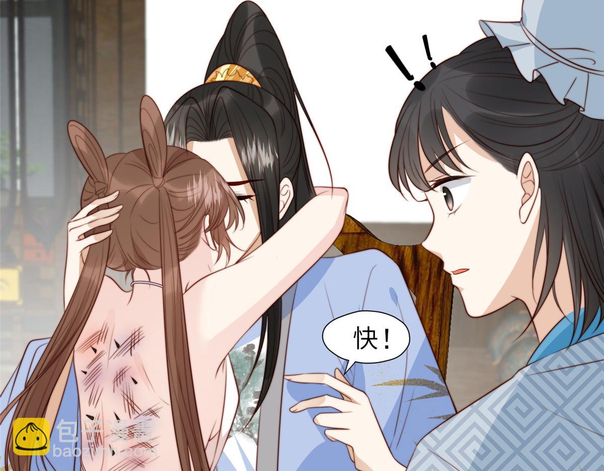 《摆烂后我掌控王爷芳心》45 敢伤本王的人？ 第17页