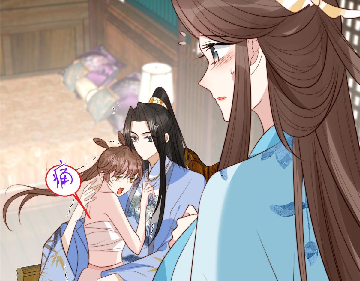 《摆烂后我掌控王爷芳心》45 敢伤本王的人？ 第35页