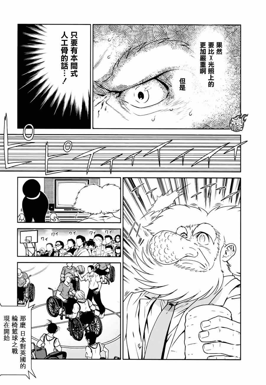 《青年黑杰克》第33话 伤痕累累的17岁 第11页