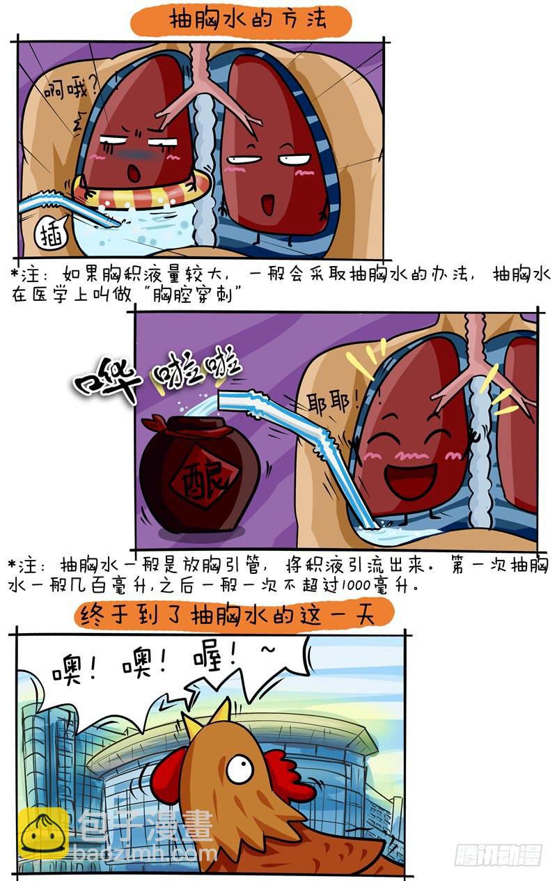 《丁神经与肿瘤君》第47话 准备抽胸水啦 第2页
