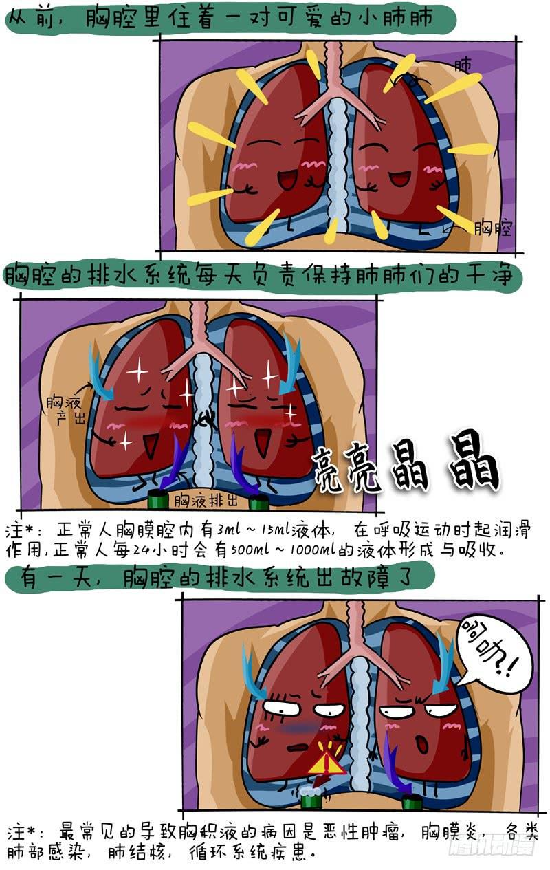 《丁神经与肿瘤君》第46话 胸腔积水 第2页