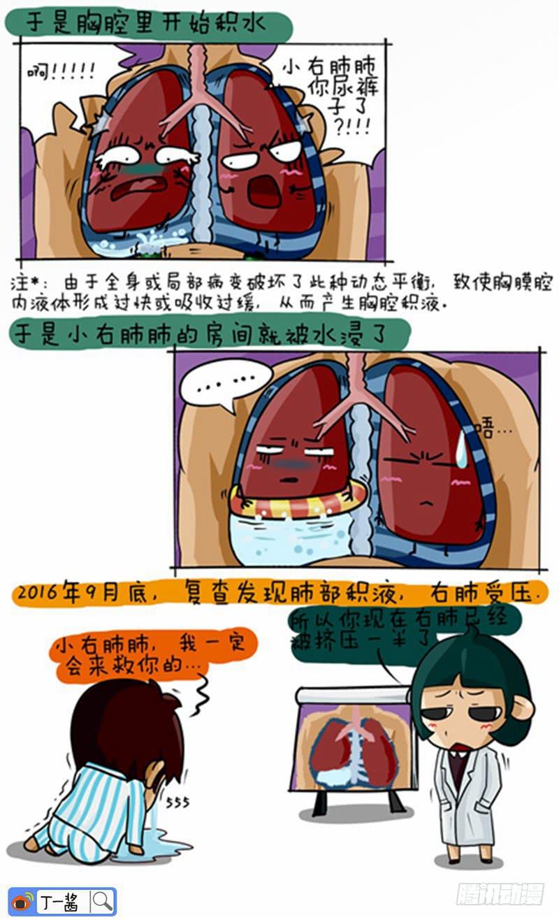《丁神经与肿瘤君》第46话 胸腔积水 第3页