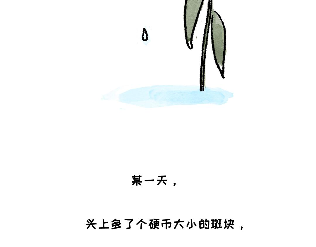 《一个人的小确幸》你知道什么叫斑秃吗 第9页