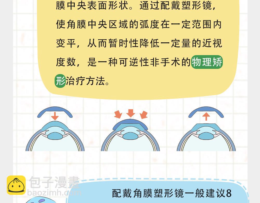 《漫话隐形眼镜》戴框架眼镜的烦恼（下） 第31页