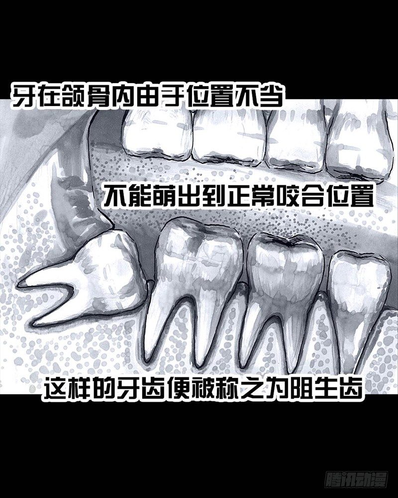 《左手的世界》番外拔牙 第23页