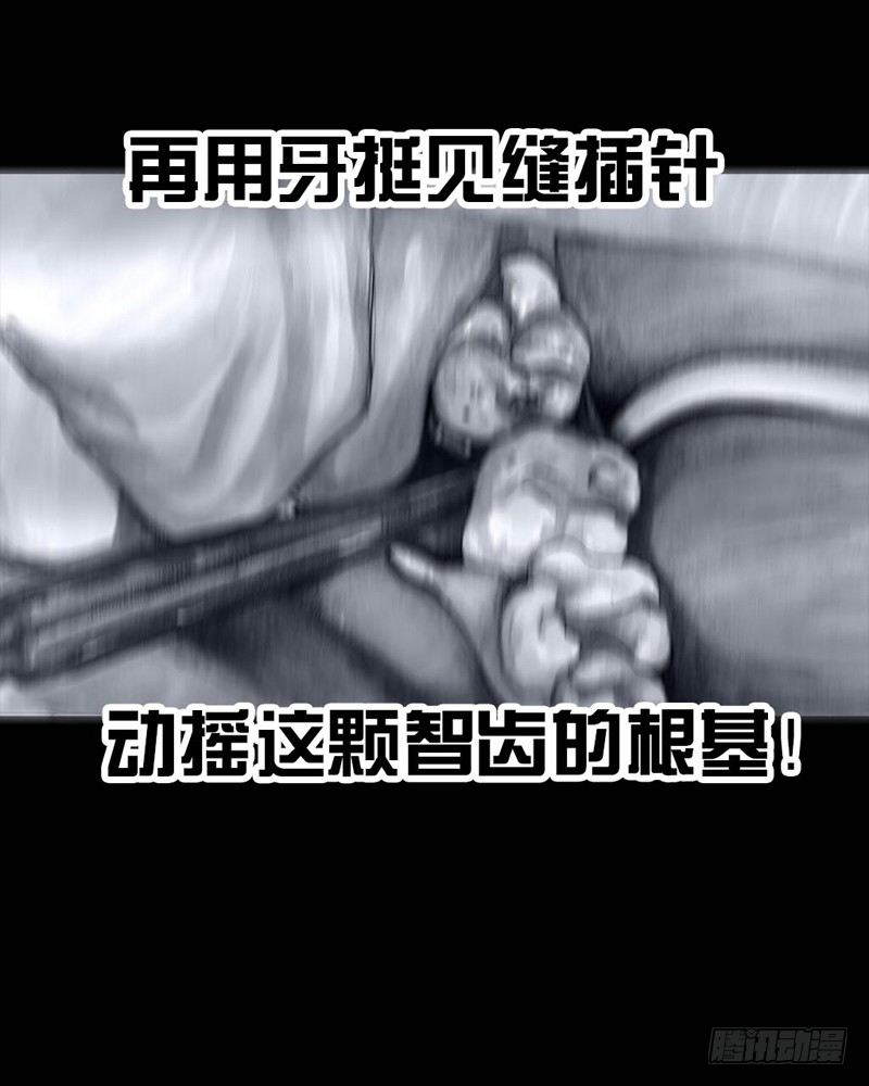 《左手的世界》番外拔牙 第42页