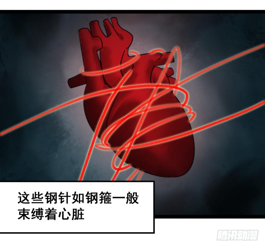 《太子仍在胃穿孔》第二十一话诅咒之身 第32页