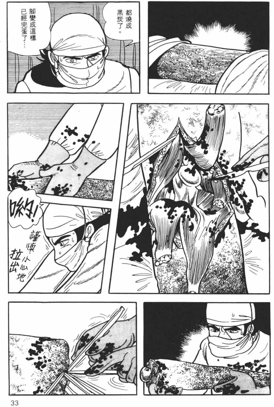 《怪医黑杰克》第11卷 第33页
